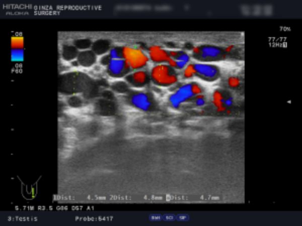 例1：左側２画面のエコー検査の画像　１枚目