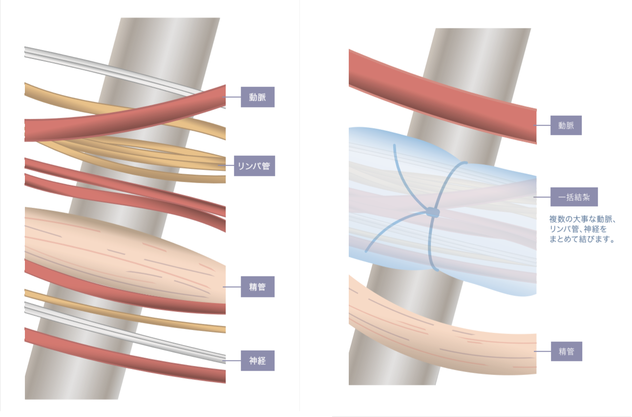 ナガオメソッドの優位性