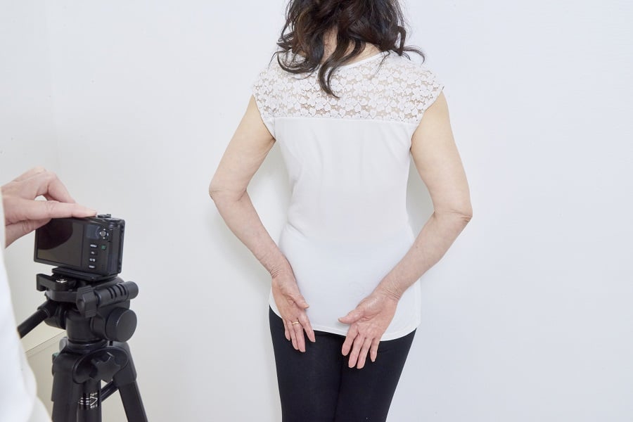 リンパ浮腫手術前の撮影_上肢1