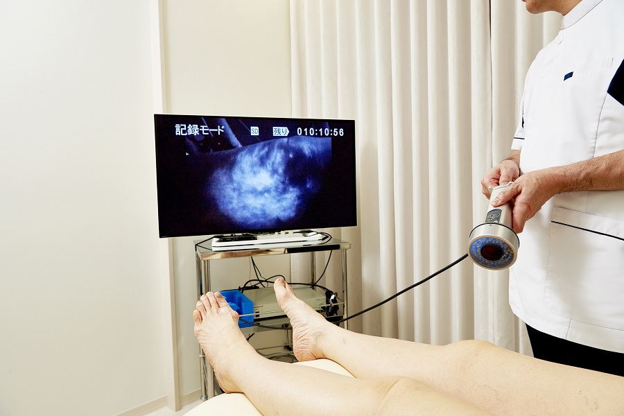 IGCリンパ管造影