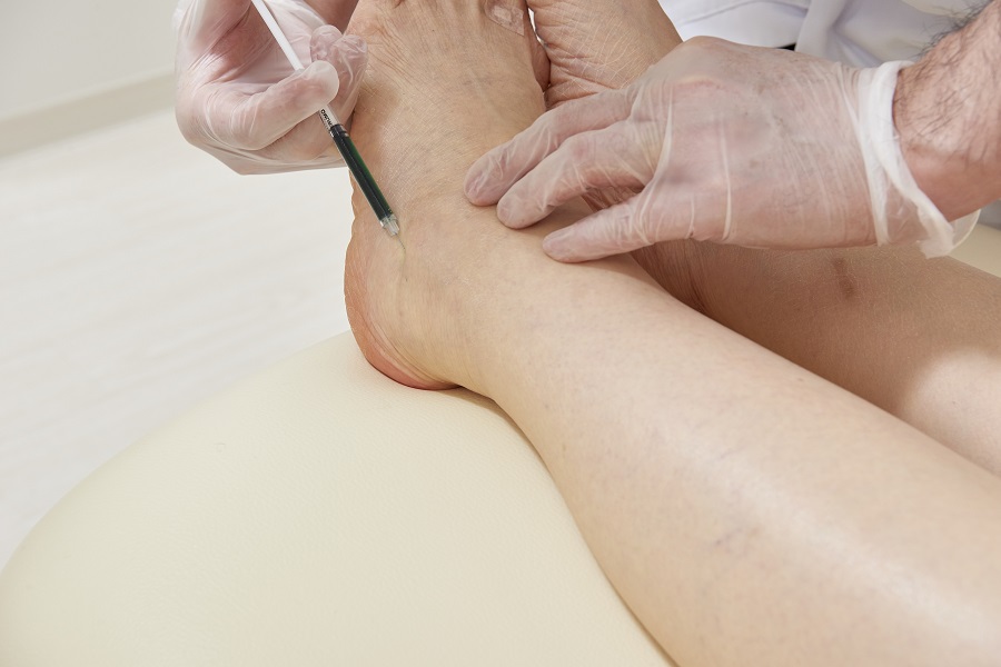 IGC Lymphangiography: Imaging_Lower Limb_2