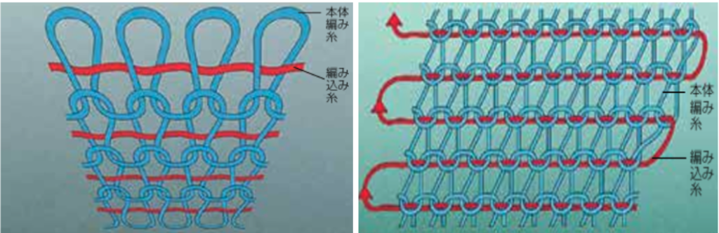 リンパ浮腫におけるストッキング
