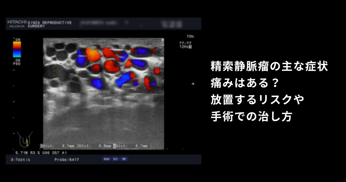 精索静脈瘤の主な症状｜痛みはある？放置するリスクや手術での治し方