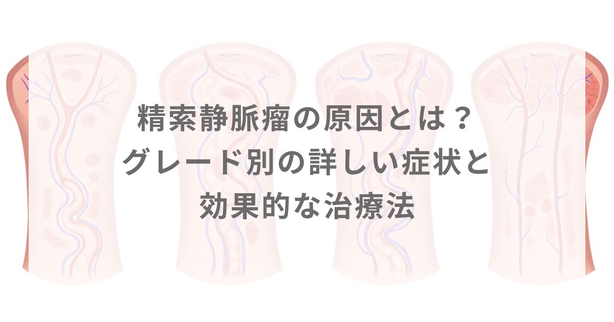 精索静脈瘤の原因とは？グレード別の詳しい症状と効果的な治療法